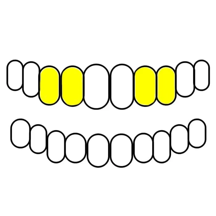 Bling Cartel Admin Rings Real Solid 14K Gold Double OpenSolid Custom Caps Custom Grillz